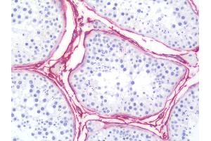 Anti-NGFR / CD271 / p75 antibody IHC staining of human testis. (NGFR anticorps)