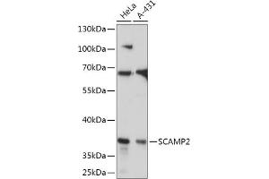 Western blot analysis of extracts of various cell lines, using SC antibody (ABIN7270188) at 1:1000 dilution. (SCAMP2 anticorps  (AA 1-152))