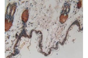IHC-P analysis of Mouse Skin Tissue, with DAB staining. (CASP14 anticorps  (AA 1-257))