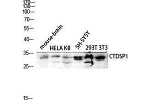 Western Blot (WB) analysis of Mouse Brain HeLa KB SH-SY5Y 293T 3T3 lysis using CTDSP1 antibody. (CTDSP1 anticorps  (N-Term))