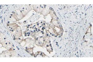 ABIN6278120 at 1/100 staining Human prostate tissue by IHC-P.
