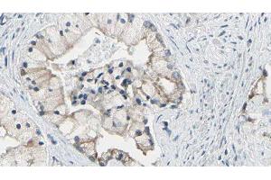 ABIN6278120 at 1/100 staining Human prostate tissue by IHC-P. (TRIM29 anticorps  (Internal Region))