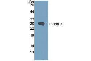 Figure. (Phosphoglucomutase 1 anticorps  (AA 1-235))