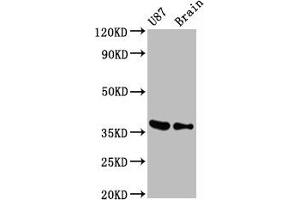 Western Blot Positive WB detected in U87 whole cell lysate 77ouse brain tissue All lanes GAPDH antibody at 0. (Recombinant GAPDH anticorps)