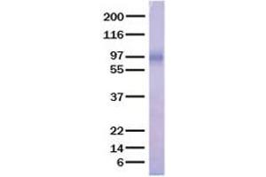 Validation with Western Blot
