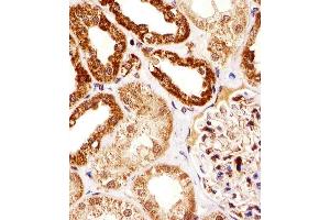 Immunohistochemical analysis of paraffin-embedded H. (SSNA1 anticorps  (N-Term))