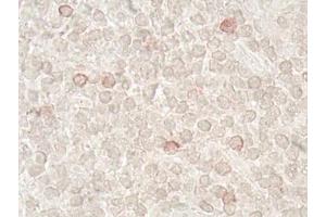 Immunohistochemistry analysis of human tonsil tissue (60x) using LAG-3 (human) recombinant mAb (L4-PL33), at a dilution of 1:50 (LAG3 anticorps  (N-Term))