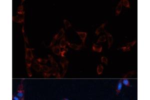 Immunofluorescence analysis of NIH/3T3 cells using GPC4 Polyclonal Antibody at dilution of 1:100. (GPC4 anticorps)