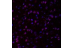 Immunofluorescent analysis of paraformaldehyde-fixed rat brain using,HECTD1 (ABIN7074186) at dilution of 1: 2000 (HECTD1 anticorps)