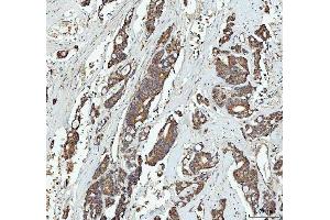 IHC analysis of GRB10 using anti-GRB10 antibody (ABIN7599160). (GRB10 anticorps  (AA 1-251))
