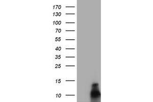 Image no. 5 for anti-FXYD Domain Containing Ion Transport Regulator 3 (FXYD3) antibody (ABIN1498341)
