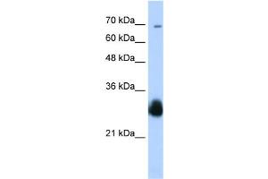 WB Suggested Anti-RNF138 Antibody Titration:  0. (RNF138 anticorps  (C-Term))