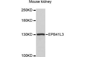 Western blot analysis of extracts of mouse kidney, using EPB41L3 antibody (ABIN6290317) at 1:3000 dilution. (EPB41L3 anticorps)