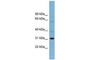 Image no. 1 for anti-Chromosome 22 Open Reading Frame 31 (C22orf31) (AA 71-120) antibody (ABIN6742136) (C22orf31 anticorps  (AA 71-120))