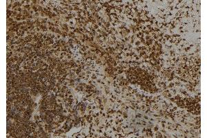 ABIN6260445 and ABIN6266445 at 1/100 staining Human spleen tissue by IHC-P. (CAPG anticorps  (Internal Region))