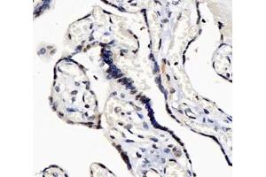 Immunohistochemistry analysis of paraffin-embedded human placenta using,GINS2 (ABIN7074041) at dilution of 1: 3000 (GINS2 anticorps)