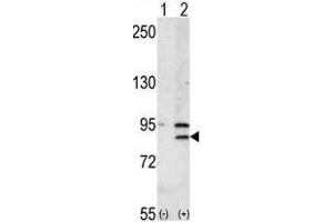Western blot analysis of BRD2 (arrow) using rabbit polyclonal BRD2 Antibody (Center) (ABIN392609 and ABIN2842131). (BRD2 anticorps  (AA 170-200))