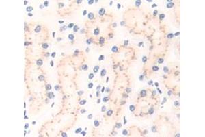 Used in DAB staining on fromalin fixed paraffin- embedded Kidney tissue