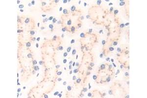Used in DAB staining on fromalin fixed paraffin- embedded Kidney tissue (CD101 anticorps  (AA 666-937))