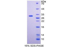 SDS-PAGE (SDS) image for V-Fos FBJ Murine Osteosarcoma Viral Oncogene Homolog (FOS) (AA 55-298) protein (His tag) (ABIN2127174) (FOS Protein (AA 55-298) (His tag))