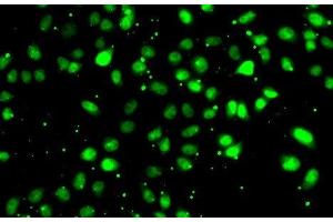 Immunofluorescence analysis of HeLa cells using NUDT2 Polyclonal Antibody (NUDT2 anticorps)