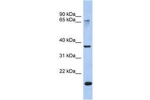 Image no. 1 for anti-Annexin A10 (ANXA10) (AA 179-228) antibody (ABIN6742711) (Annexin a10 anticorps  (AA 179-228))