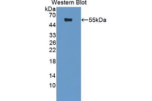 Western blot analysis of the recombinant protein. (DPP7 anticorps  (AA 28-486))