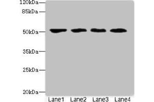 Western blot All lanes: LRRC42 antibody at 10 μg/mL Lane 1: MCF-7 whole cell lysate Lane 2: A549 whole cell lysate Lane 3: HCT116 whole cell lysate Lane 4: Colo320 whole cell lysate Secondary Goat polyclonal to rabbit IgG at 1/10000 dilution Predicted band size: 49 kDa Observed band size: 49 kDa