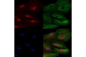 ABIN6260017 and ABIN6266498 staining  cells by IF/ICC.