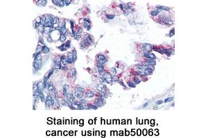Image no. 1 for anti-Baculoviral IAP Repeat-Containing 5 (BIRC5) antibody (ABIN363217) (Survivin anticorps)