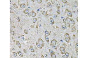 Immunohistochemistry of paraffin-embedded Mouse brain using PDIA6 Polyclonal Antibody at dilution of 1:100 (40x lens).