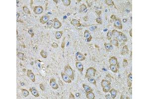 Immunohistochemistry of paraffin-embedded Mouse brain using PDIA6 Polyclonal Antibody at dilution of 1:100 (40x lens). (PDIA6 anticorps)