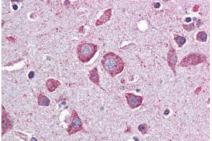 Human Brain, Cortex: Formalin-Fixed, Paraffin-Embedded (FFPE)