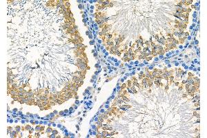 ABIN6261279 and ABIN6278060 at 1/100 staining Rat testis tissue by IHC-P.