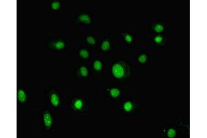 Immunofluorescent analysis of HepG2 cells using ABIN7153807 at dilution of 1:100 and Alexa Fluor 488-congugated AffiniPure Goat Anti-Rabbit IgG(H+L) (GTF2H5 anticorps  (AA 1-71))