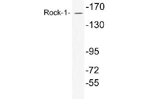 Western blot (WB) analysis of Rock-1 antibody in extracts from COS7 cells. (ROCK1 anticorps)