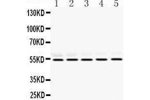 Western Blotting (WB) image for anti-Retinoblastoma Binding Protein 4 (RBBP4) (AA 395-425), (C-Term) antibody (ABIN3043920) (Retinoblastoma Binding Protein 4 anticorps  (C-Term))