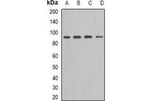 Western blot analysis of Kv11. (KCNH2 anticorps)