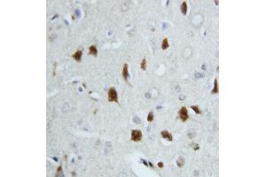 Anti-Hsc70 antibody, IHC(P) IHC(P): Rat Brain Tissue