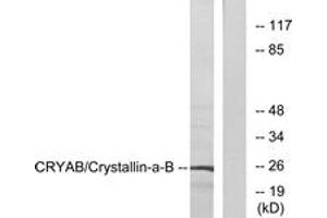 Western blot analysis of extracts from 293 cells, using CRYAB (Ab-19) Antibody. (CRYAB anticorps  (AA 10-59))