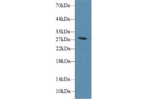 Detection of DIO3 in Rat Blood Cells lysate using Polyclonal Antibody to Deiodinase, Iodothyronine, Type III (DIO3)