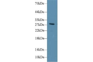 Detection of DIO3 in Rat Blood Cells lysate using Polyclonal Antibody to Deiodinase, Iodothyronine, Type III (DIO3) (DIO3 anticorps  (AA 37-169))