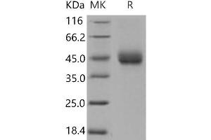 Western Blotting (WB) image for Tissue Factor Pathway Inhibitor (Lipoprotein-Associated Coagulation Inhibitor) (TFPI) (Active) protein (His tag) (ABIN7198255)