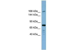 WB Suggested Anti-DAPK1 Antibody Titration: 0. (DAP Kinase 1 anticorps  (N-Term))