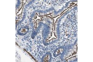 Immunohistochemical staining of human small intestine with TMEM180 polyclonal antibody  shows distinct granular cytoplasmic positivity in glandular cells at 1:20-1:50 dilution. (TMEM180 anticorps)