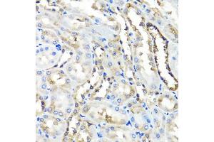 Immunohistochemistry of paraffin-embedded rat kidney using HYAL1 antibody (ABIN5975045) at dilution of 1/100 (40x lens). (HYAL1 anticorps)