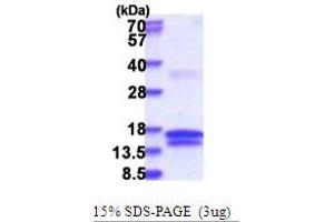 SDS-PAGE (SDS) image for Uridine-Cytidine Kinase 1 (UCK1) (AA 143-273) protein (His tag) (ABIN5853718)