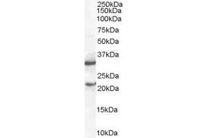 ABIN184575 staining (2 µg/mL) of mouse spleen lysate (RIPA buffer, 35 µg total protein per lane). (SOCS1 anticorps  (C-Term))