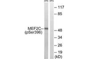 Western blot analysis of extracts from NIH-3T3 cells treated with starved 24h, using MEF2C (Phospho-Ser396) Antibody. (MEF2C anticorps  (pSer396))