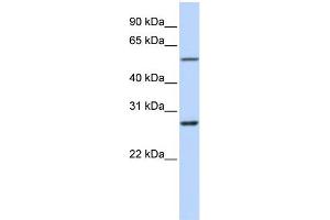WB Suggested Anti-RNF217 Antibody Titration:  0. (RNF217 anticorps  (Middle Region))